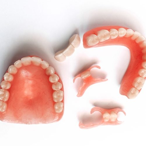 Partials-Full-Dentures